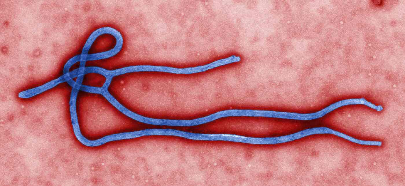 The Protein That Makes Ebola So Deadly Has Finally Been Identified